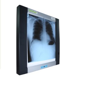 .X ray viewer (single)